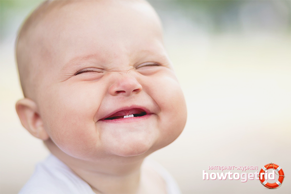 Hogyan lehet enyhíteni a fogak fájdalmát egy gyermeknél