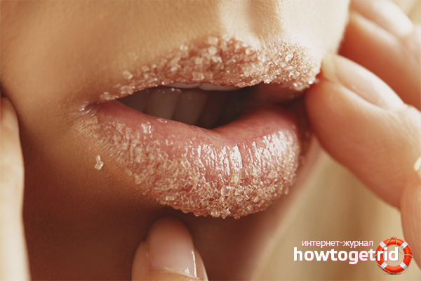Kako se riješiti suhih usana