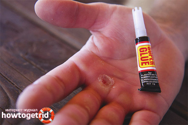 How to remove glue moment from hands