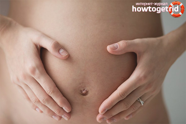 Apendicitis terhesség alatt